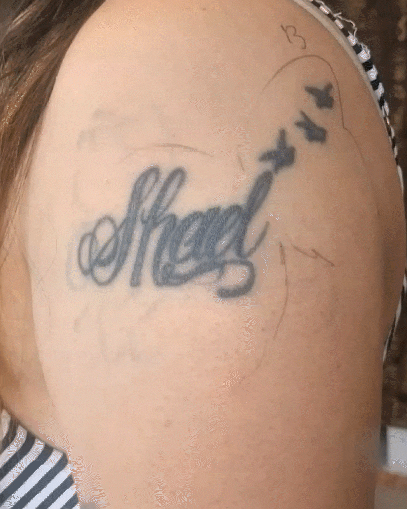 Cover-up
